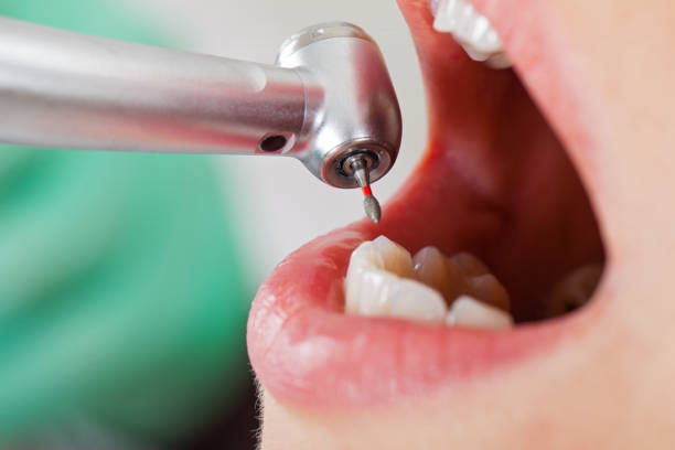 Best Same-Day Emergency Dental Services in Curtisville, PA